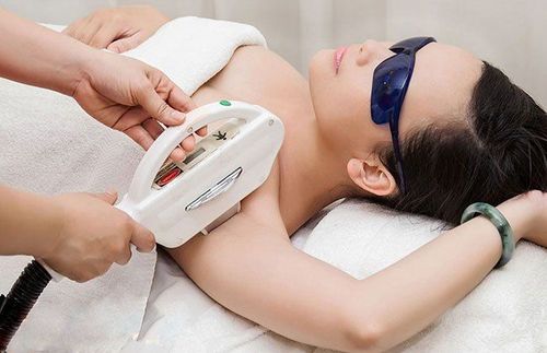 
Loại bỏ lông bằng laser là một trong các phương pháp triệt lông nách hiện nay
