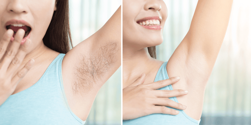 Should armpit hair be shaved or plucked?