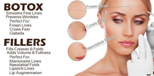 Types of wrinkle fillers on the face