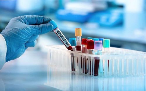 Clonorchis sinensis IgG test for small liver flukes