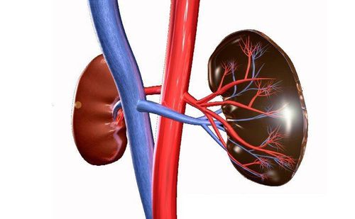 
Bệnh huyết khối tĩnh mạch thận thường khởi phát với triệu chứng rối loạn chức năng thận kín đáo
