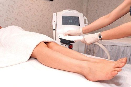 
Tẩy lông bằng laser có an toàn không là nỗi băn khoăn của nhiều người
