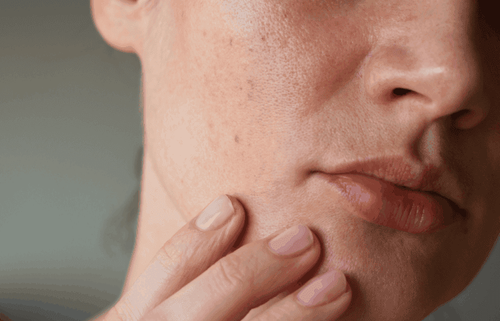 Dermatologists' top tips for soothing dry skin