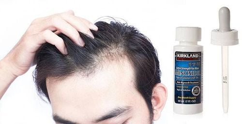 Minoxidil 5% có kích thích tóc mọc nhanh không?