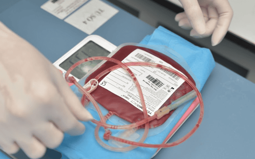 Umbilical cord blood: What you need to know