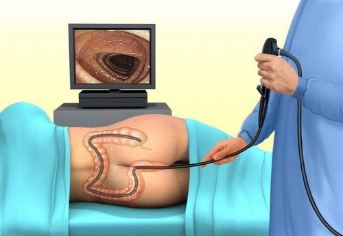 Afraid of colonoscopy to screen for cancer - there are still other methods