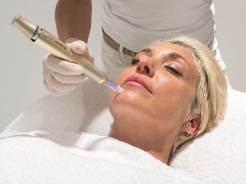 What is facial microneedling and is it good?