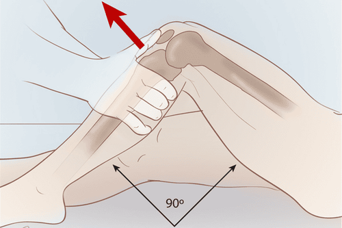 
Điểm Beighton là một phương pháp chẩn đoán giãn dây chằng
