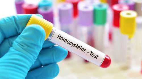 What is the Homocysteine ​​test for?