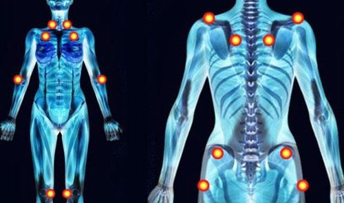 Fibromyalgia and chest pain