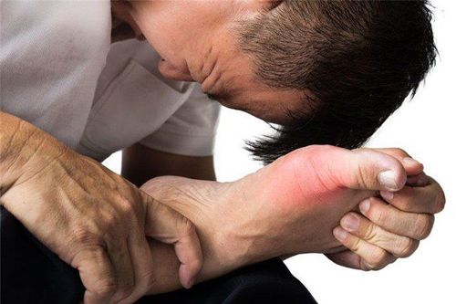 Sưng đau các khớp ngón chân có phải bị Gout không?