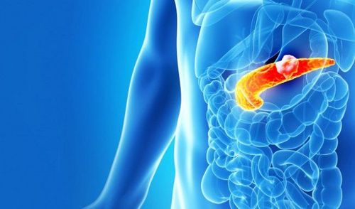 Ung thư tuyến tụy giai đoạn cuối di căn gan và hạch điều trị như nào?