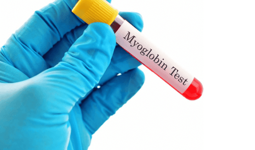 How is the Myoglobin test performed?