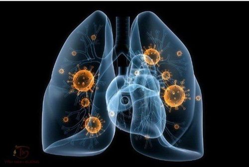 Lao phổi đã điều trị khỏi có thể tái phát không?