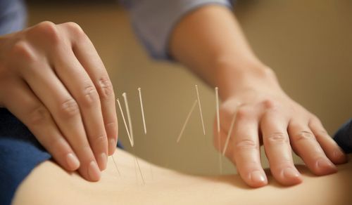 Acupuncture weight loss, true or not true?