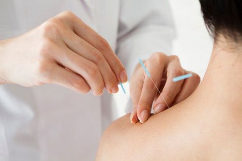 Acupuncture for shoulder pain?