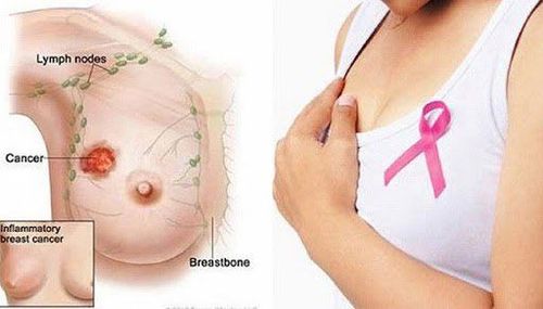 Breasts: Normal and Unusual