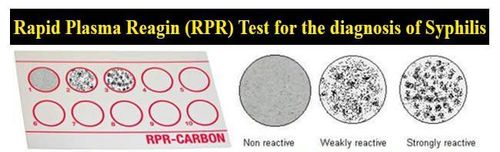 
RPR là phản ứng sàng lọc giang mai phổ biến nhất hiện nay
