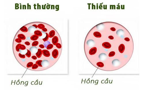 How can anemia deplete you?