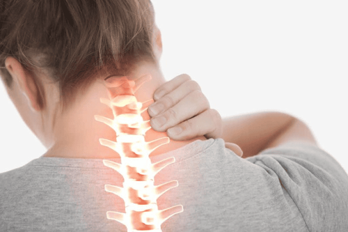 Treating cervical discs: managing neck pain at home