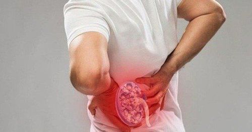 Home remedies to treat kidney stones