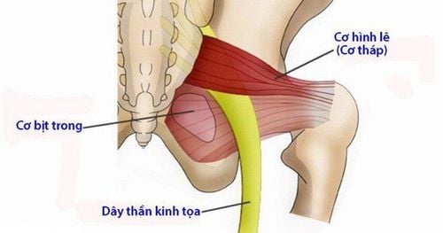 
Hội chứng cơ hình lê (cơ tháp)
