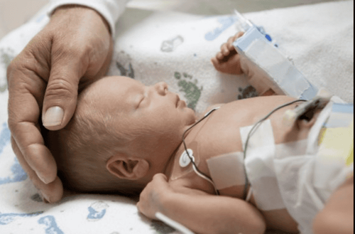 Evaluation and initial management of neonates with cyanosis (Part 2)