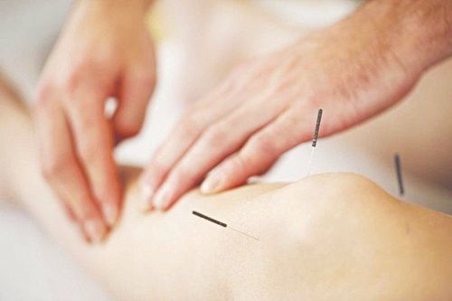 Does Acupuncture Cause You Pain?