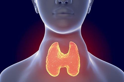 Manifestations of toxic multinodular goiter