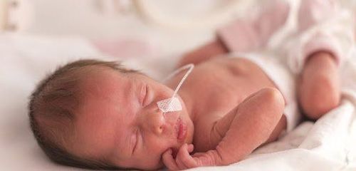 ECMO in neonates with severe respiratory failure