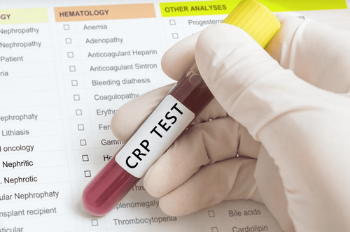 Testing for hs-CRP and cardiovascular disease