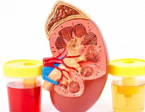 ADDIS sediment test and nephrotic syndrome