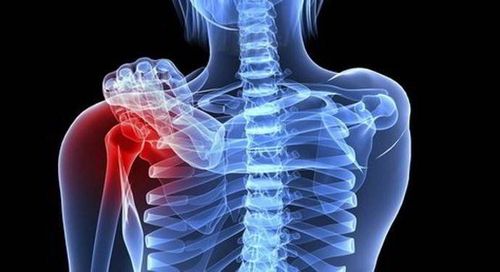 Đồng vị phóng xạ có thể giúp giảm đau do ung thư di căn xương