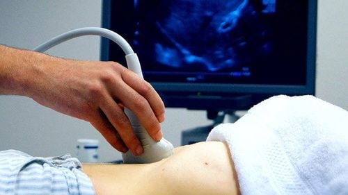 Can an abdominal ultrasound detect ovarian cysts?