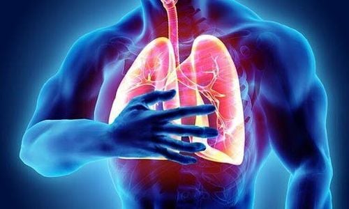 Tràn dịch dưỡng trấp màng phổi ở ca lâm sàng u lympho không Hodgkin tế bào B lớn