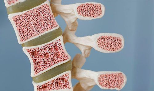 Bone marrow biopsy and bone marrow aspiration