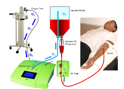 
Liệu pháp O3_AHT mang lại nhiều kết quả điều trị khả quan.
