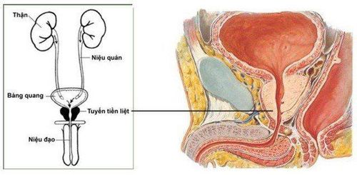 
Bệnh nhân ung thư tuyến tiền liệt được chỉ định dùng thuốc Histrelin
