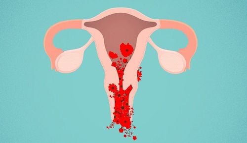 Menstruation 3 times a month is a symptom of what disease?