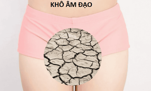 Khô âm đạo có phải do tiêm HPV không?