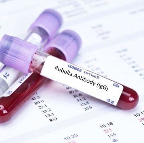 Mang thai 13 tuần xét nghiệm Rubella IgG dương tính có sao không?