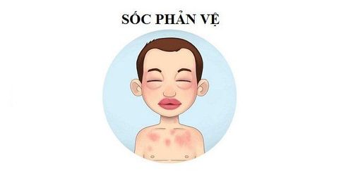 
Sốc phản vệ là phản ứng dị ứng nghiêm trọng của dị ứng dưa hấu
