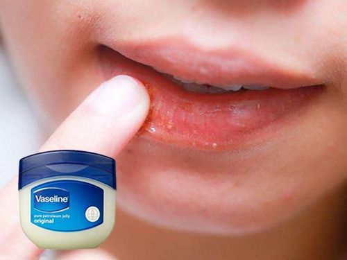 Should you use Vaseline on your lips?