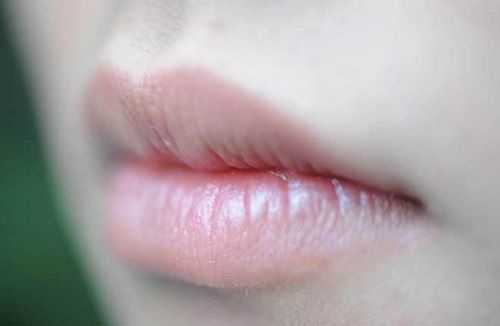 Lip discoloration: Meaning and treatment