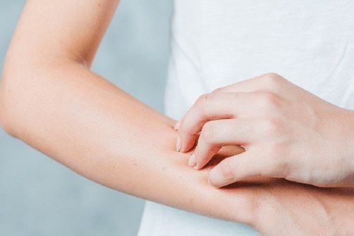 
Ngứa môi có thể do bệnh lupus, nổi mề đay
