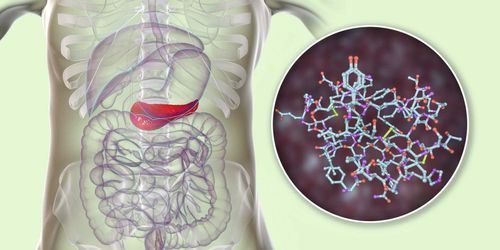 Rối loạn dự trữ glycogen type 3