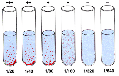 Salmonella widal test: Indications, meaning