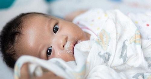 Nôn trớ ở trẻ sơ sinh có chữa được không?