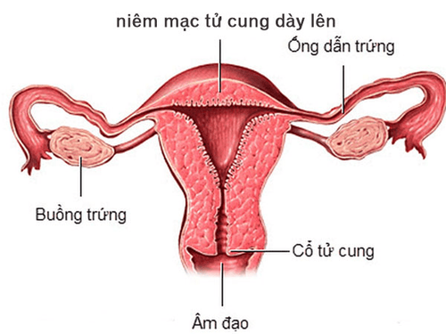 Missing period, thick endometrium, not yet showing gestational sac, is it pregnant?