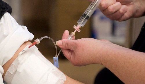 Intravenous chemotherapy in cancer treatment